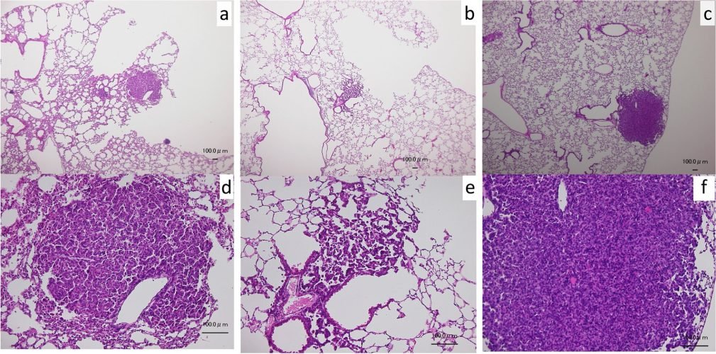 b56602c40786 Jus Actinidia arguta (sarunashi) inhibe le cancer du poumon chez la souris